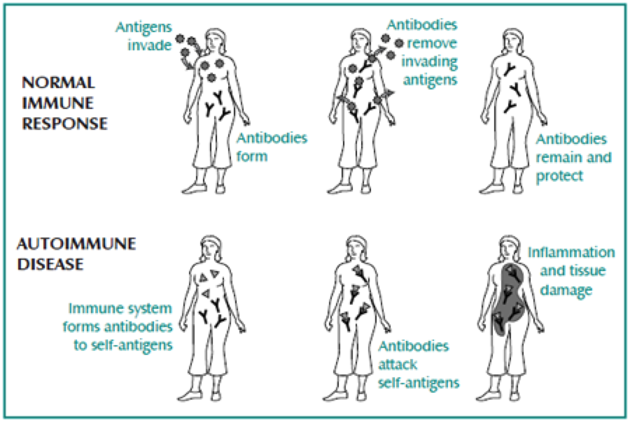 AndGzDz's tweet photo. Autoimmune Disorders https://t.co/tt14n2pr9f https://t.co/s2EoXmqEpk