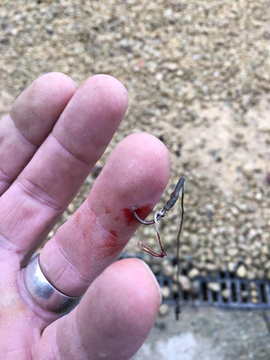 Heather Clawson on X: Hand damage day today! 🤕🤢🥴🤕. Hubby had to go to  A&E #northwich to get a #barbed #hook out of his finger after tidying the  shed! 🤢 And i