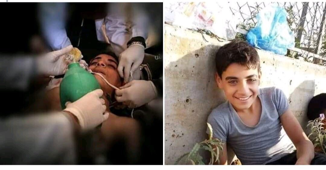 ComPalestinaCL's tweet photo. Abdel Salha de 14 años, murió asesinado por el Ejército de Israel, luego de ser herido por una bala en la cabeza el pasado viernes en #Gaza.

Desde el año 2000, un niño palestino es asesinado cada tres días, mientras el mundo calla y lo permite. https://t.co/2hHsYccRzv