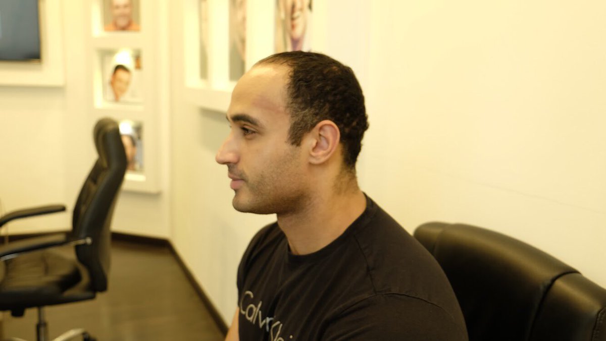 ahsdubai's tweet photo. [BEFORE ➡️ BEFORE ➡️ AFTER ➡️ AFTER]

Welcoming Mohamed Naeem Salama to the Advanced Hair Studio family! He never had a full head of hair in his life &amp; we gave him not only hair to play &amp; style with but also more confidence!

Stay tuned for more details on his hair journey! https://t.co/IPveobRIL2