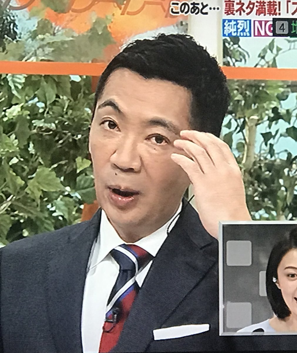 宮根誠司 整形