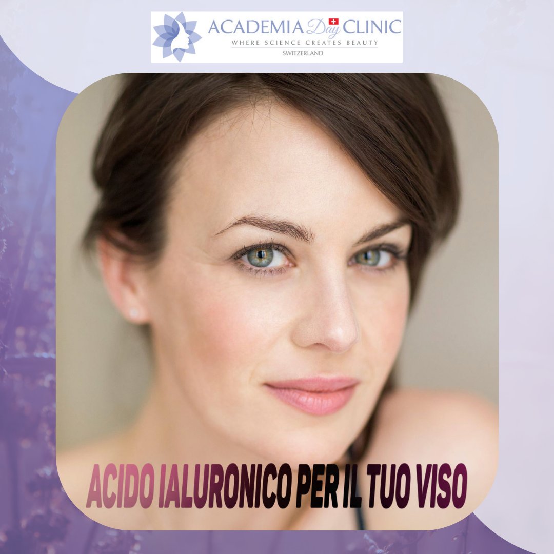 filler acido ialuronico viso