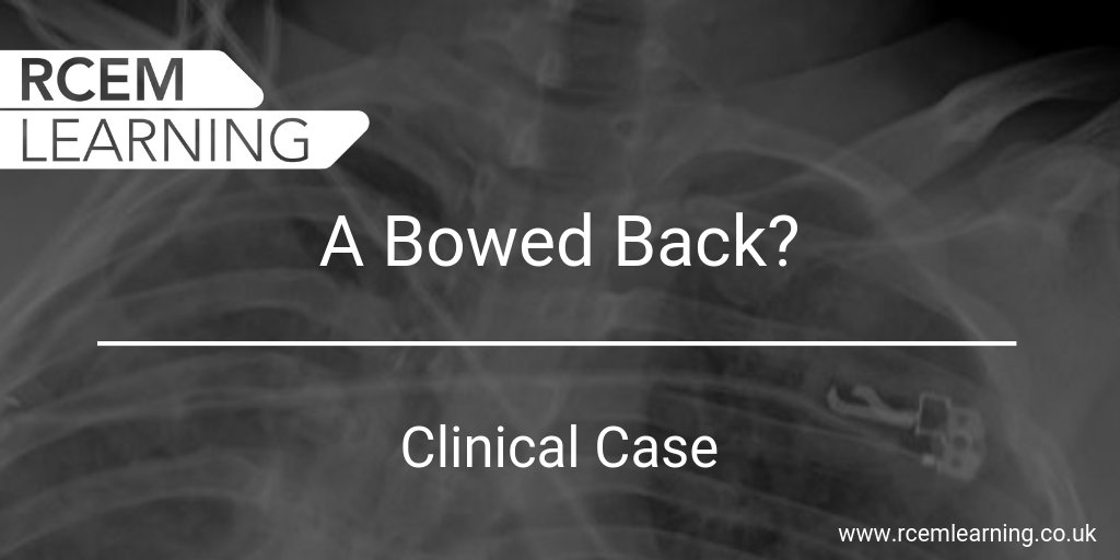 RCEMLearning tweet media