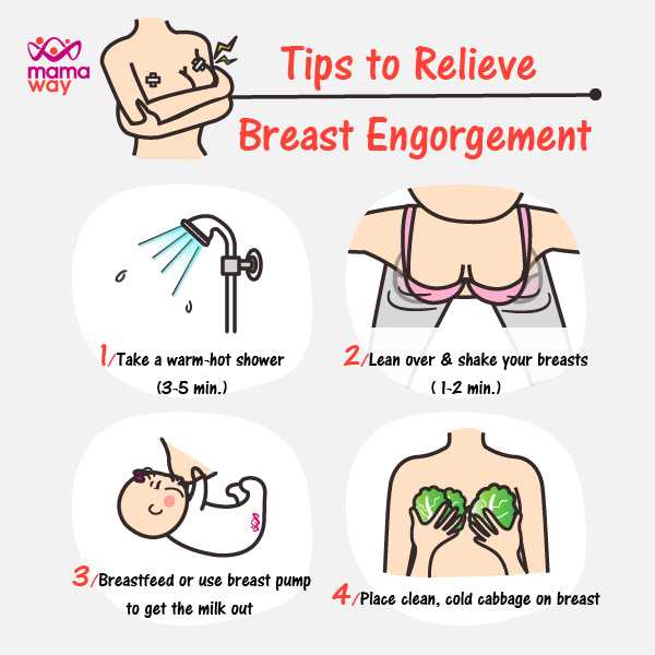 What is breast engorgement ? How to get relief?