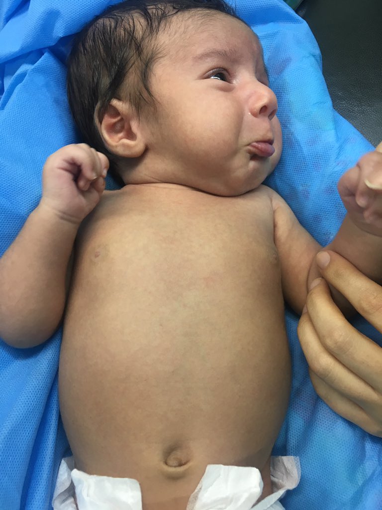 velombedebaba's tweet photo. آورده بودن ختنش كنن قيافش همچين شده بود ☹️ https://t.co/HpEje9XRby