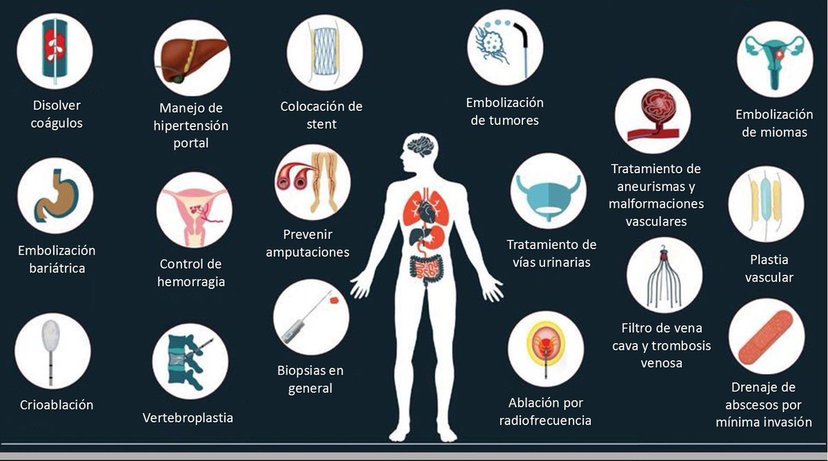 _jossimar's tweet photo. #interventionalradiology https://t.co/krx3rsLKdy