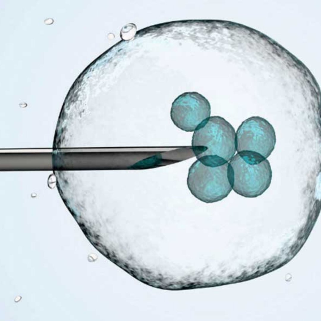 ÖLEN KOCASININ DONMUŞ SPERMİNİ KULLANMASINA İZİN VERİLMEDİ
bit.ly/2SBUQub

#Biomedya #sperm #tüpbebek #embriyo #tedavi #turkcelldergilik