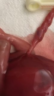 jcollinsmd77's tweet photo. OB Facts: UCA- Constriction requires an autopsy when discovered. https://t.co/aYtj28uMOu