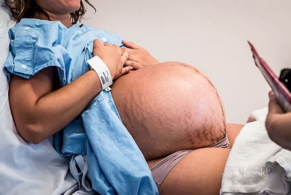 A womb for two 👶🏽👶🏽Who is expecting or gave birth to twins? X midwife Sofie 
📷:@catfancote.capturingbirth
.
.
.
#newmom #newfamily #breastfeeding #breastisbest #tattoomum #bottlefeed #placenta #naturalbirth