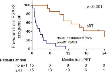 Can Local Ablative Radiotherapy Revert Castration-resistant #ProstateCancer to an Earlier Stage of Disease? buff.ly/2s68gCW