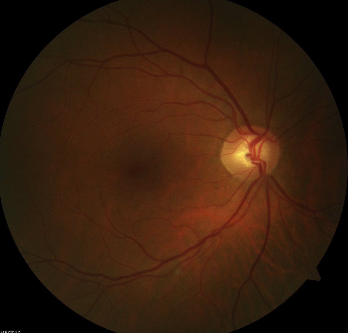 OptometryTimes tweet picture
