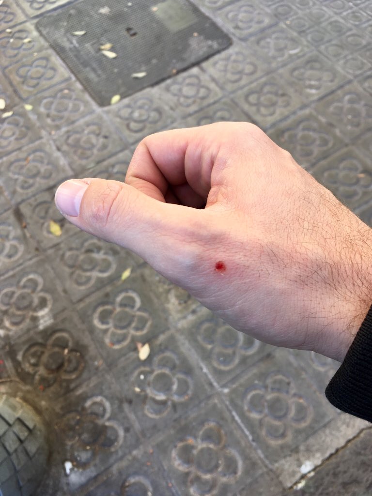 ehmusic's tweet photo. Deberían ponerle nombre a esta lastimadura de tanto sacar y volver a guardar el TEL en el bolsillo del jean #MilennialProblems https://t.co/NQaV9yvNLm