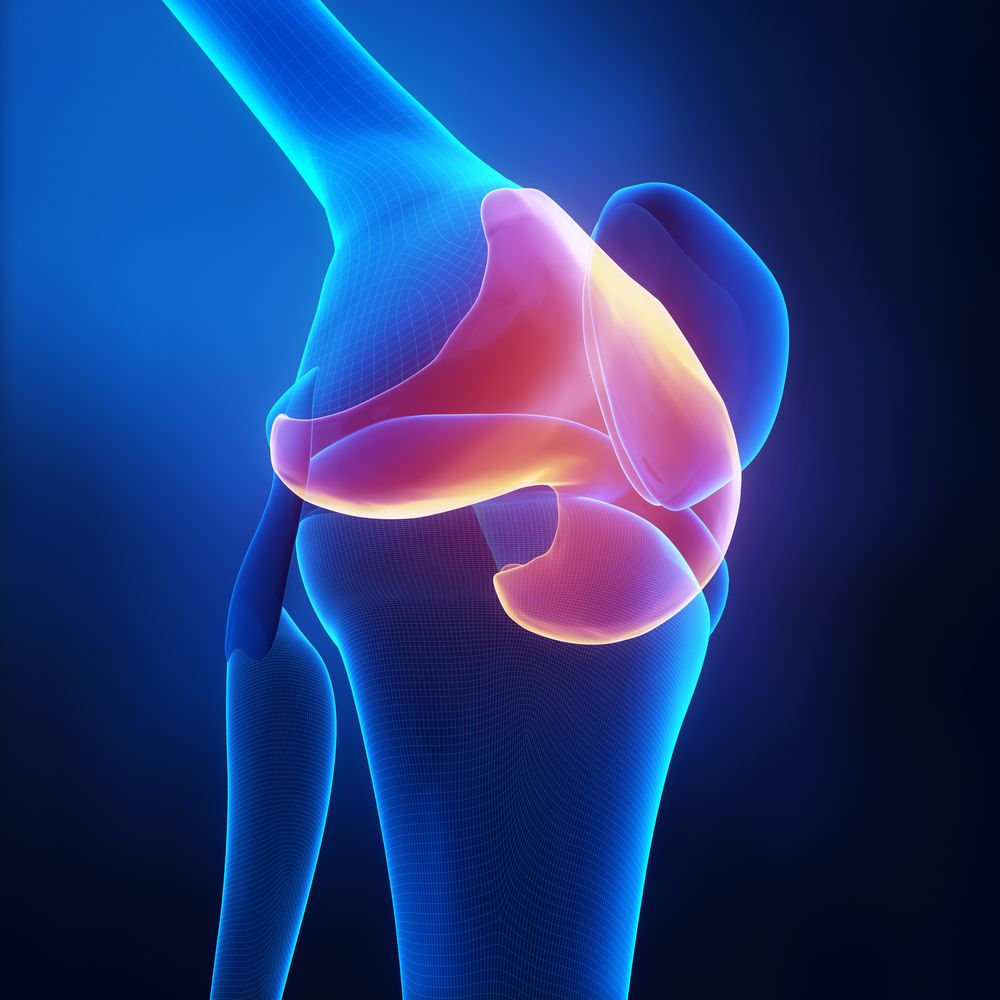 In patients with large #articularcartilage defects, or in defects involving the bone, an effective treatment for the cartilage deficiency is a fresh osteoarticular allograft. medilink.us/yi1k