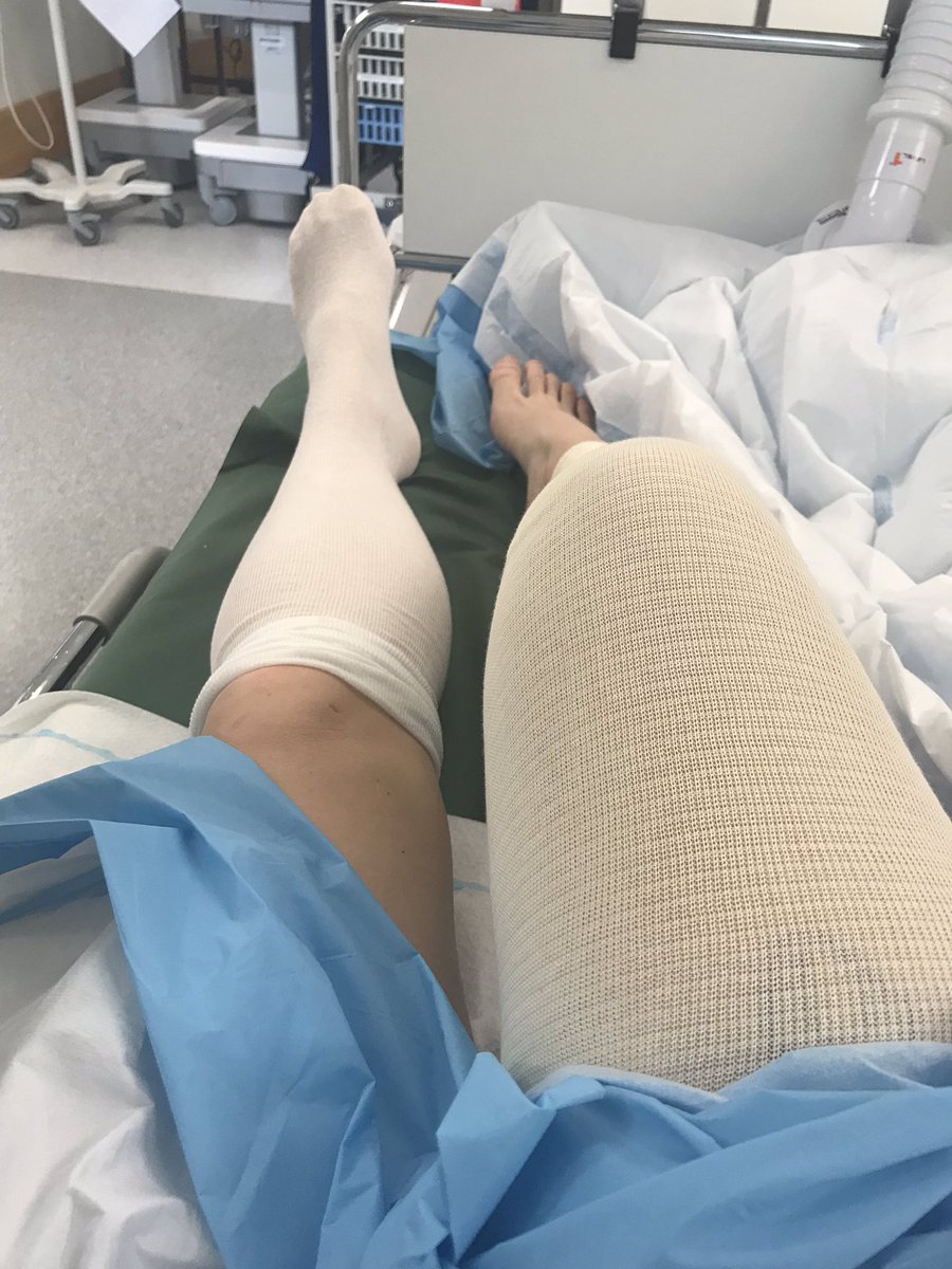 7e knäoperationen ✅ vaknade upp med några peppmess på telefonen varav 5 är från fysioterapeuter från förr😂 skönt att man ändå va en uppskattad patient ” krya på dig” finns här om du behöver mig❤️