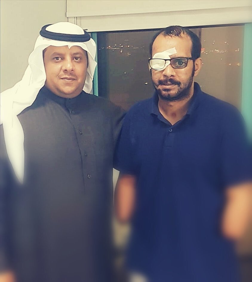البطل جارالله بن علي العمري فقد إحدى عينيه وكلتا يديه في الحد الجنوبي دفاعاً عن دينه ووطنه، أسال الله أن يعوضه خيراً منها وأن يجزيه عنا خير الجزاء في الدنيا والآخره، وأن يكتب له الصحة والعافية. #السعودية #الحد_الجنوبي #بني_عمرو
