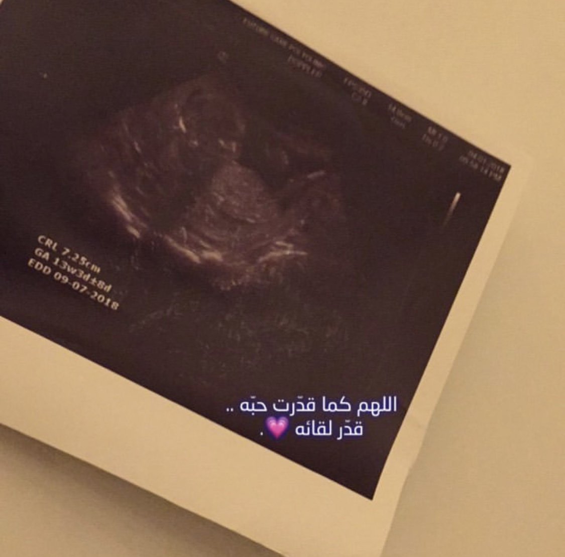 meme77971's tweet photo. #اشياء_تهب_لك_السعاده
دوماً كنت أظن أن الرجال الأفضل حظاً في الحياة ، حتى سمعت نبضات جنيني وشعرت بركلاته المتتاليه حينها أدركت روعة أن أكون إمرأة ..
👶🏻♥️♥️ https://t.co/TqHqOSWkdS