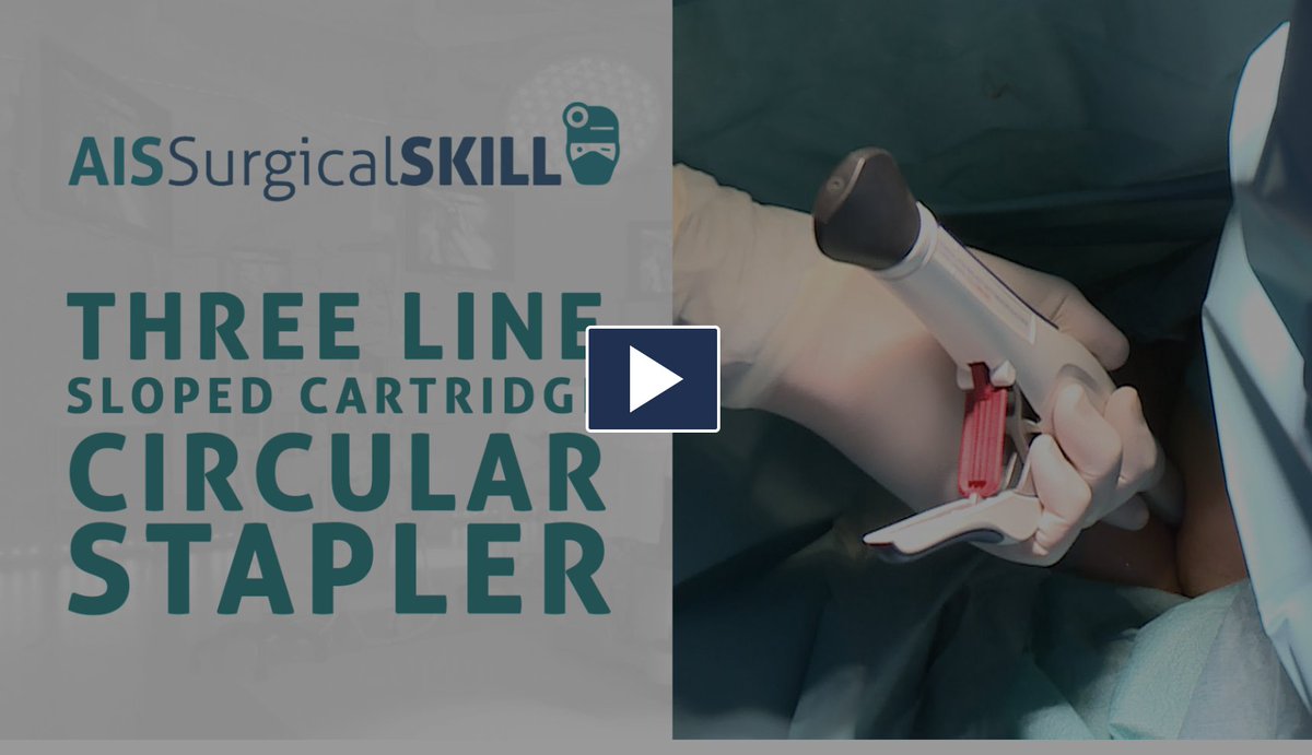 AntoniodeLacy's tweet photo. Surgical Skills: Three-line / sloped cartridge Circular Stapler https://t.co/DYb4SSVyx6 #surgery #edtech #education https://t.co/kGwJ1Nvpie