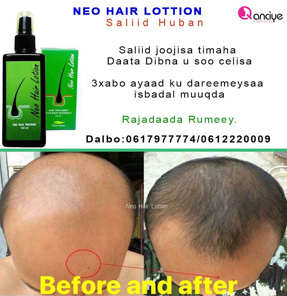 #mogadishu ayaa laguu keenay waxaad ka dalban kartaa <a href="/somarts/">SOMArts</a> <a href="/ladan90907393/">Ladan Barkade</a> <a href="/ahmedvision1/">Ahmed Vision</a> @DalmarHassanQ <a href="/skysportsomalia/">Sky Sports Somalia</a>