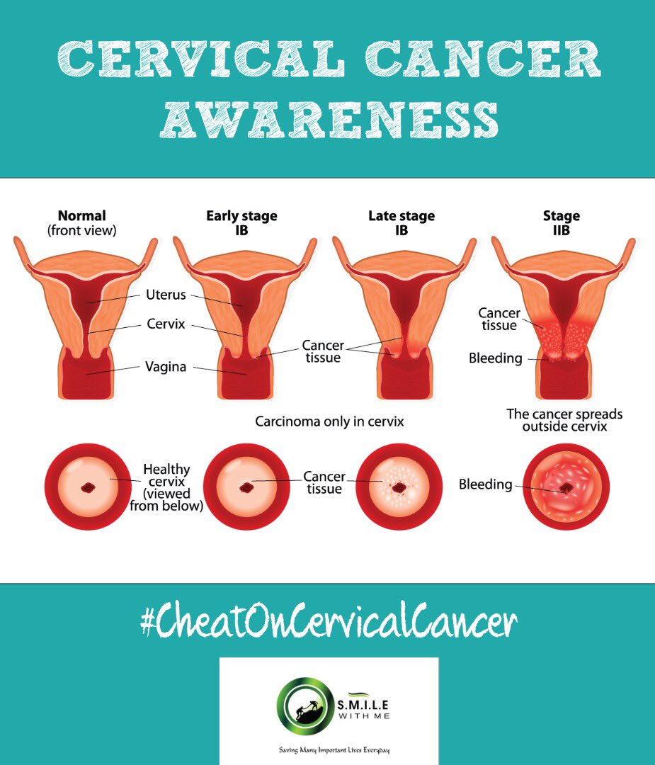 healtharmyng's tweet image. Slay Mama on the Outside, Gucci Bag Gang, LB Red Bottoms... Team Baby Girl For Life... Abeg, have you done a Pap Smear ?  Have you heard about Cervical Cancer ? Have you been Vaccinated ? Ladies, Gbe Body e oh #CheatOnCervicalCancer