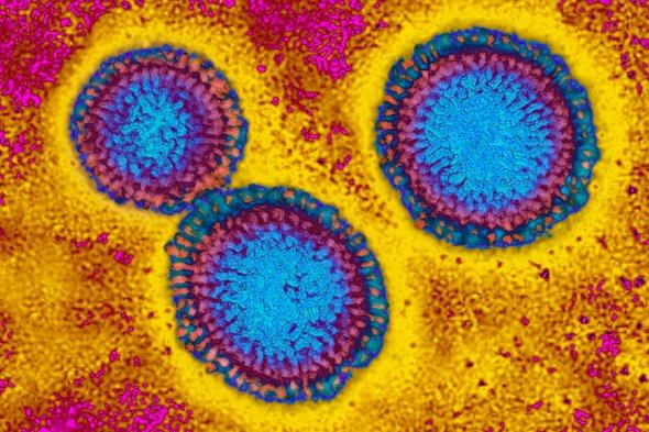 How does the flu actually kill people? bit.ly/2LUnMv0