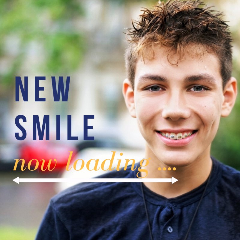 Are you ready for your new smile? 

#NewSmile