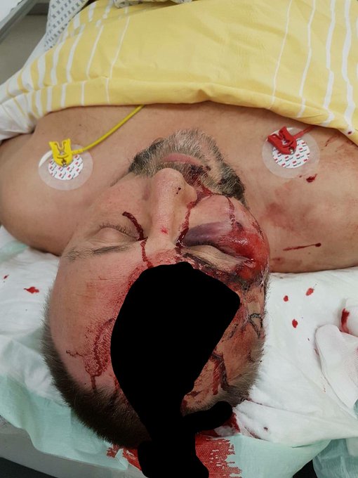 Προβολή εικόνας στο Twitter