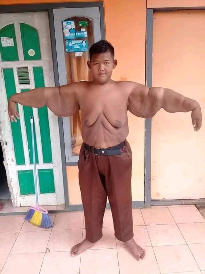 BeritaTmptnMy's tweet photo. Arya Permana budak lelaki yg viral dari Indonesia...berat badan yg dulunya mencecah dari 192kg kini turun hingga 88kg!! 

Serius...adik ni memang seorang yang sangat tabah.. pasti banyak pengorbanan yg dia kena buat...salute... https://t.co/t6JsbsJMNK
