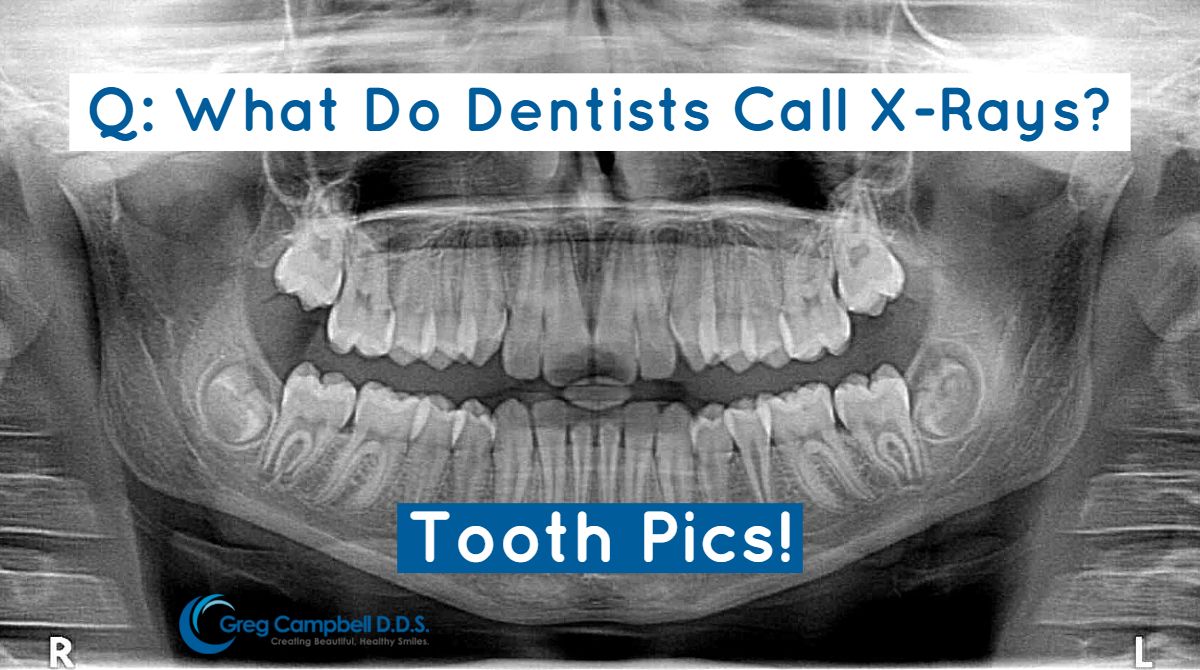 DdsCampbell's tweet photo. Monday Evening #dentaljoke Just For You!
•
•
•
•
•
#gregcampbell #longbeachdentist #dentistry #dentist #dental #teeth #smile #dentalhygiene #tooth #dentalhygienist #oralhealth #love #dentalcare #implant #whiteteeth #toothbrush #health #beauty #dentalhealth #happy #dentallife https://t.co/60Ylgeb5y2