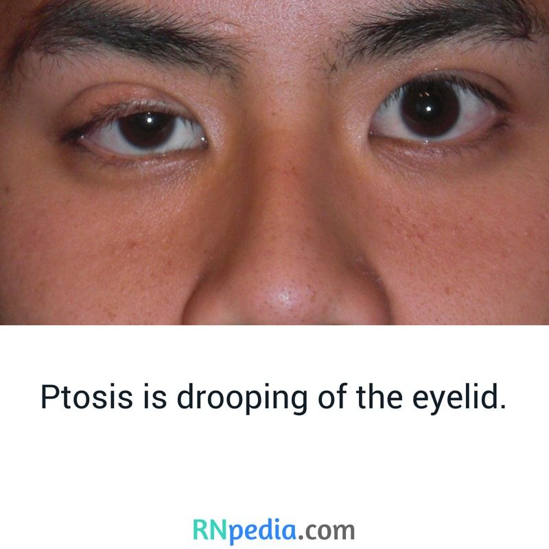 nurses_tips's tweet photo. https://t.co/7fARYYBTWV