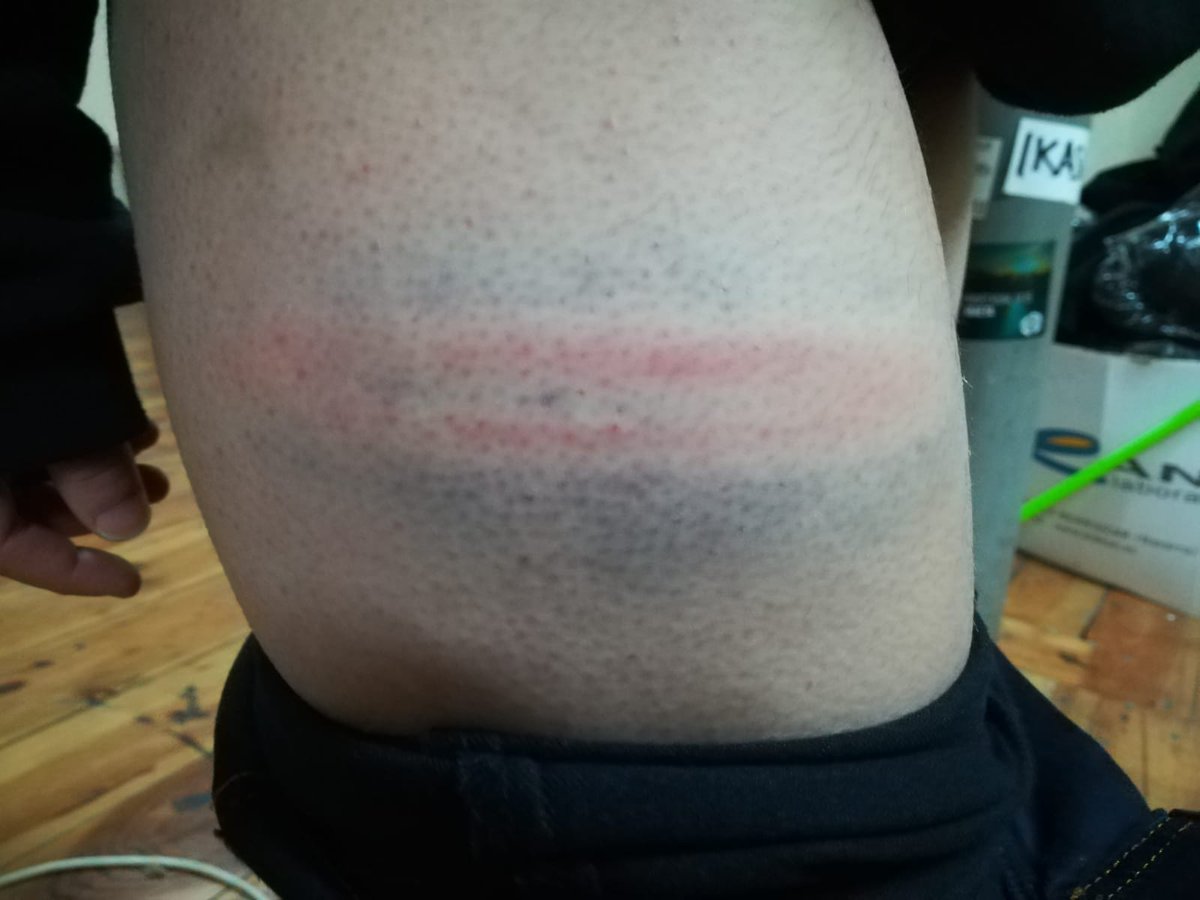 maravillasGTX's tweet photo. Aquí los únicos que ponen en riesgo a las personas son el @gob_na y su jauría de policías incontrolados #MaravillasHerriarentzat @AhotsaInfo https://t.co/ea2FHYum2c