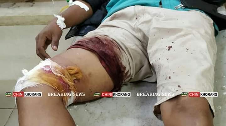 Rony Kambey (@ronykambey) on Twitter photo 