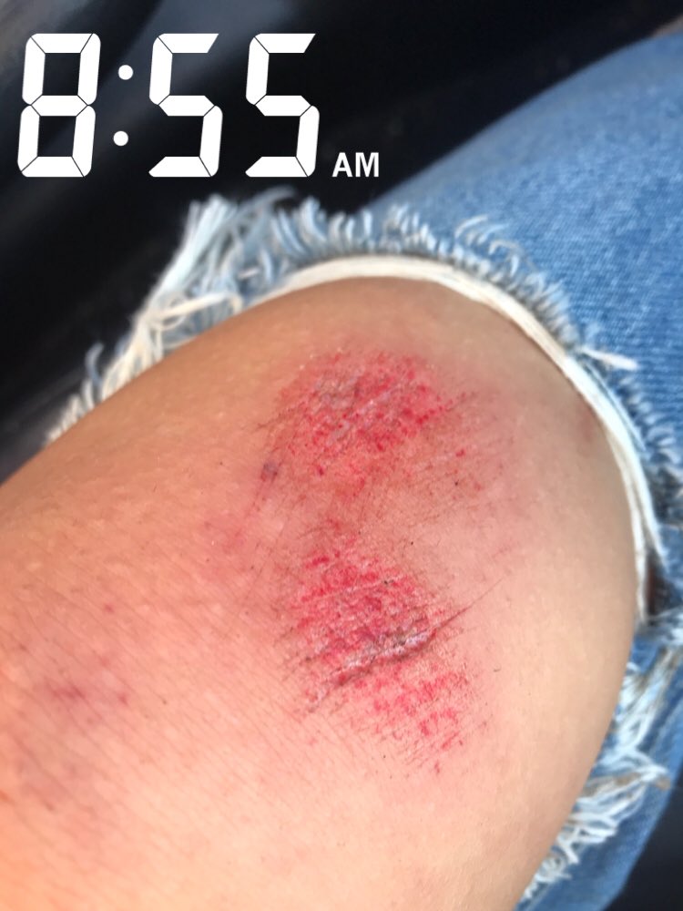 maelyn_sutliff's tweet image. @DrJeck please delay/cancel school so this doesn’t happen to a fellow fauquier county student tomorrow morning like it did to a @LCPSOfficial student this morning #slipperyice #saveus