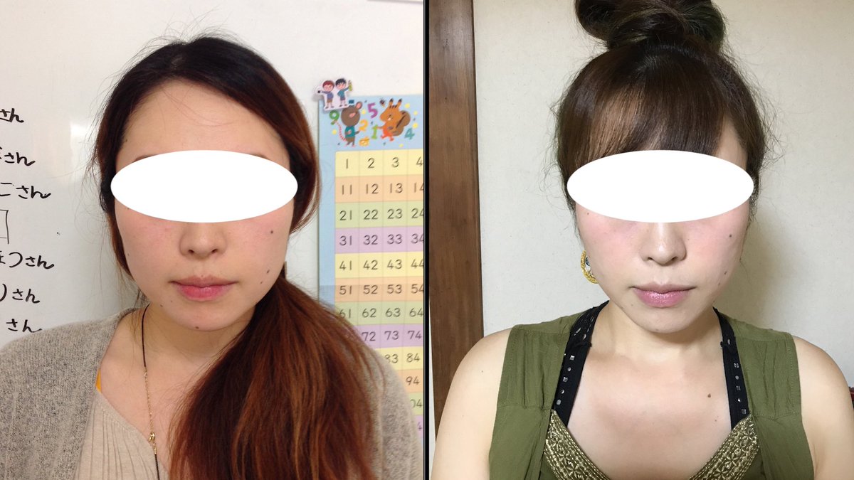 美容整体師 川島さん 書籍 可愛い顔は自力で作れる を出版中 Biyou Kawashima Twitter