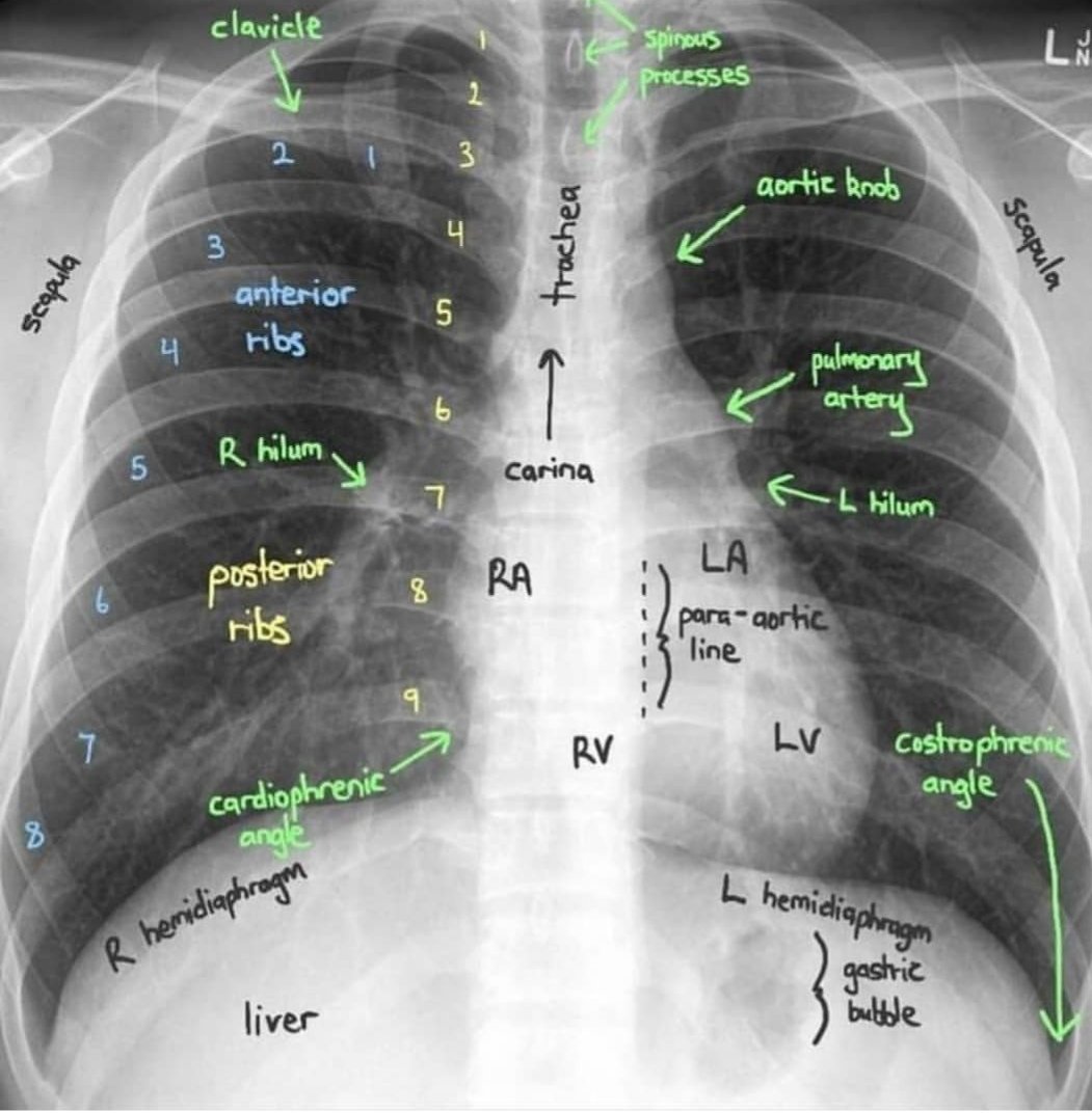 Good Morning

#medicalnotes #medicalschool #medicals