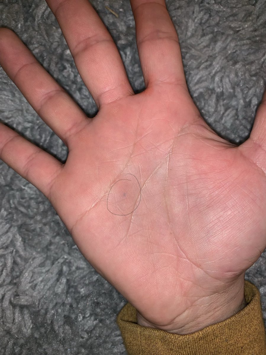 Chinohoven's tweet photo. Who else got permanent pencil led in themselves from when they were younger?????? https://t.co/yGsLWAoWSB