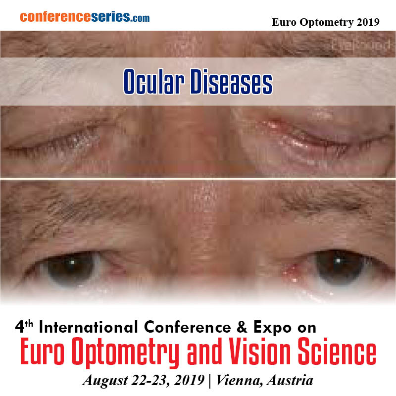 Optometry_Eye's tweet image. …ptometry.ophthalmologyconferences.com

#Optometry #VisionScience #PaediatricOptometry #VisualNeuroscience #IdiopathicIntracranial #Hypertension #Ocular #Migraine #OcularBiochemistry #OcularMicrobiology #OcularDisorders #OcularDiseases #IrisDisorders #OphthalmicDrugDeliverySystems