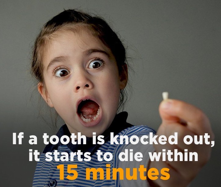 SeaCountrySmile's tweet image. To keep your (non-baby) tooth alive, put it in milk or a tooth preservation kit until you can get proper treatment.
#Knockedouttooth
