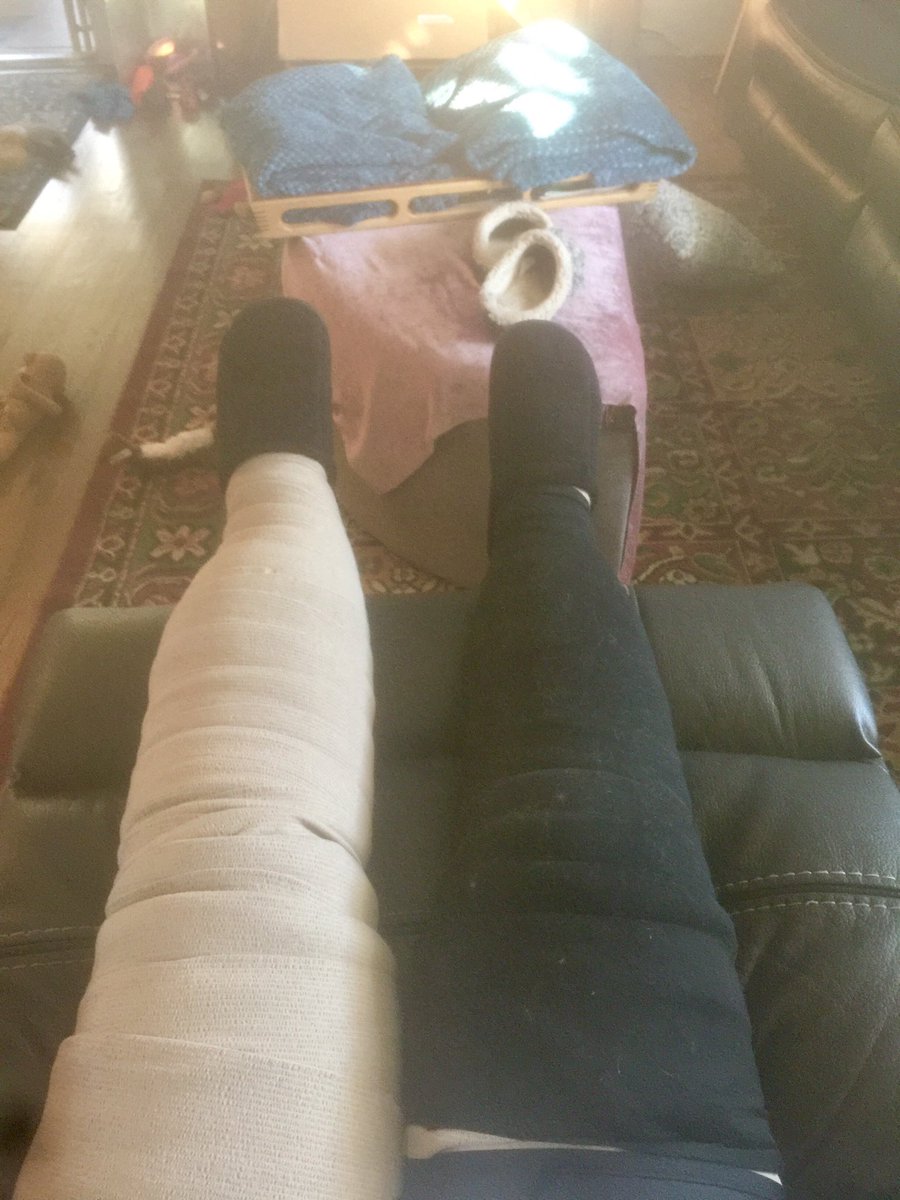 hindelible's tweet image. @LymphaticNet so thankful for great resources, training and sharing solutions. THIS is what living with lymphedema looks like #compressionworks