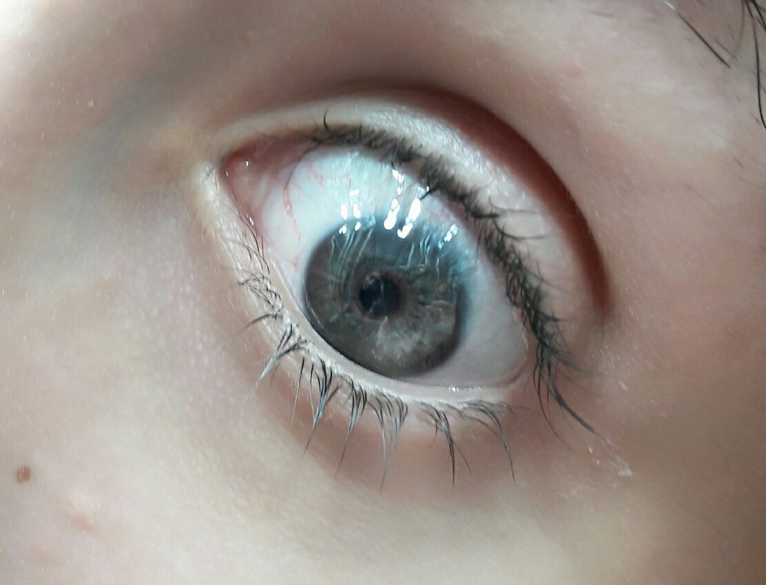 IrexLaser's tweet photo. New Year Resolution is to have new eyes. #irexlaser #lasereyecolorchange #newyear #neweyes https://t.co/lgPBpjw4Lc