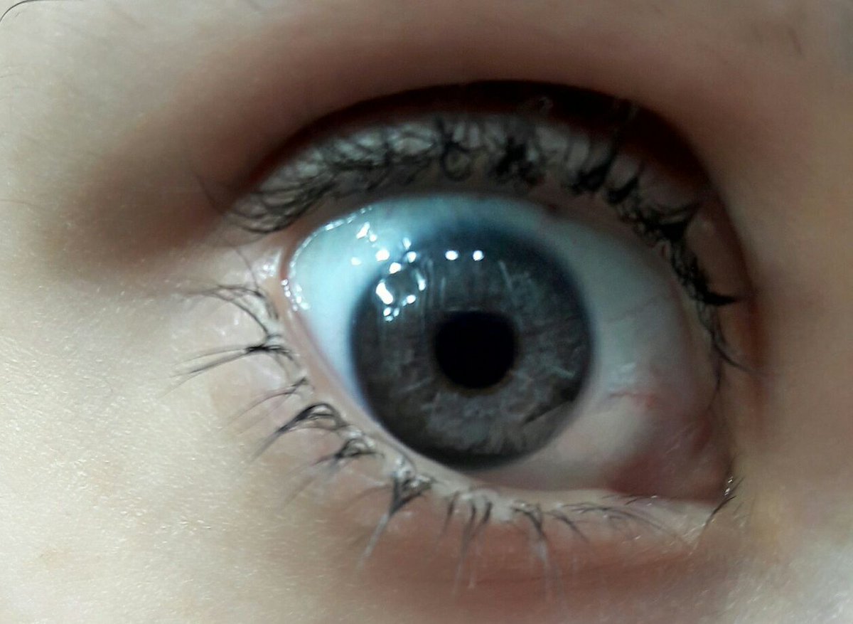 IrexLaser's tweet photo. New Year Resolution is to have new eyes. #irexlaser #lasereyecolorchange #newyear #neweyes https://t.co/lgPBpjw4Lc