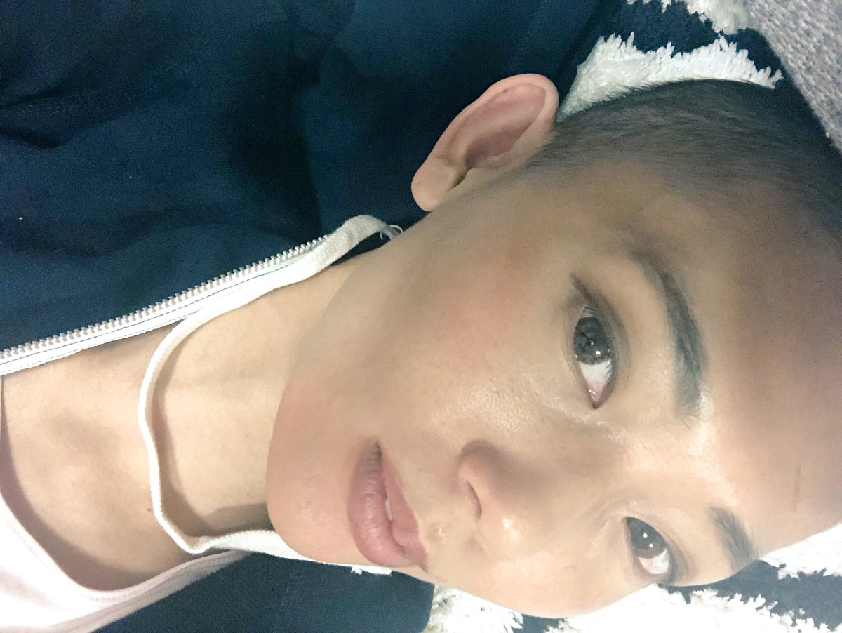 ハイブリッドコンチギャル Tomoe3 0 على تويتر どんどん毛伸びてはえてくるーwwでもまた薬変わったらハゲるかもやけどーw 抗がん剤 化学療法 肺腺癌 ハイブリッドコンチギャル Tomoe3 0 على تويتر どんどん毛伸びてはえてくるーwwでもまた薬変わったらハゲるかもやけどーw 抗がん剤 化学療法 肺腺癌