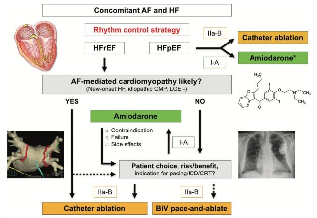 Early catheter ablation of #Afib might prevent #Atrialfibrillation mediated #cardiomyopathy
#EuropeanHeartJournal review: bit.ly/2Rz2pEV 
#heartfailure #arrhythmia #HFrEF #Pacing #antiarrhythmics #amiodarone #ventricularremodelling #EHJ #ESCCoT #ESCardioEd #CardioTwitter