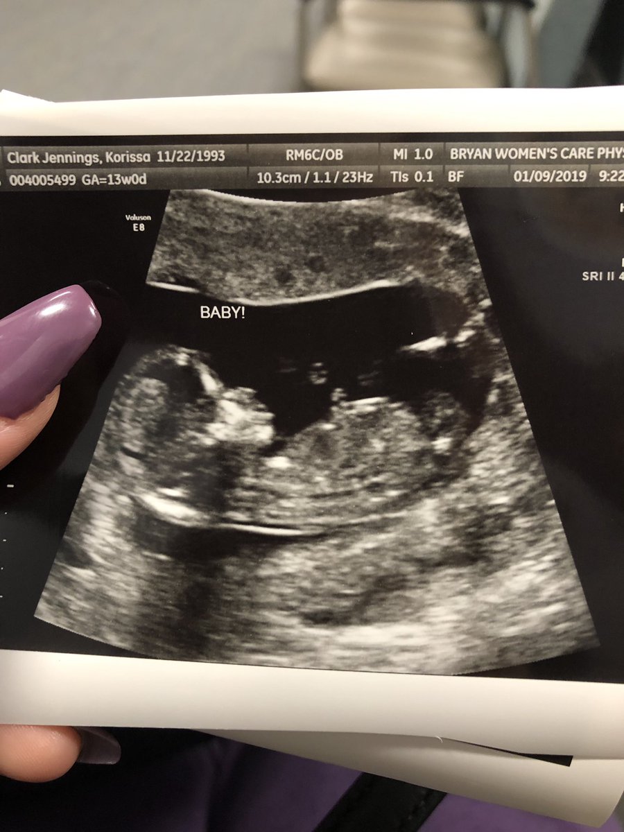DrewRill's tweet photo. Life changing moves! Best decision @korissaaa and I ever made. Such an indescribably feeling of love and happiness. Due July 17th! #PromotedToDaddy https://t.co/0nqhSgGqJs