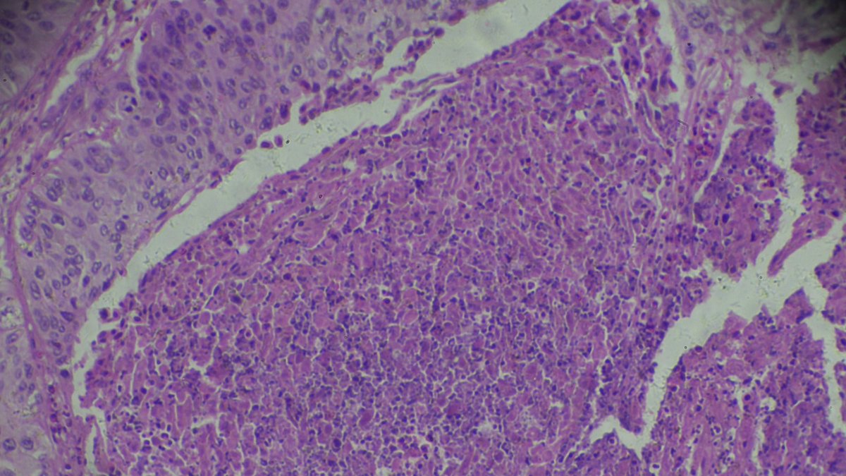 AdvPortfolio's tweet photo. Linking cancer cells to parent cells through their proteins #cancer #diagnostics #healthcare - Watch the video: https://t.co/yMZJ9oKO8J https://t.co/TgLqLBsjQ3