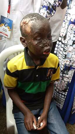 L_Amutie's tweet photo. #VictoryBelongstoJesus
THE GOD OF THE MIGHTIEST PROPHETS has healed cancer,opened blind eyes and now created a new nose.Surely victory belongs to Jesus https://t.co/qDqbjzVnrd