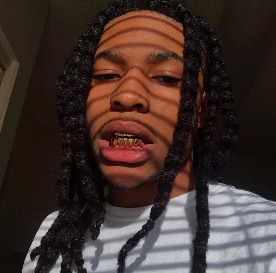 Gold Teeth Appreciation Thread:
Gleeee 🥶🥵