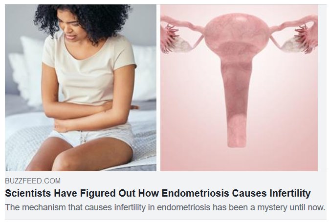 IVFMexico's tweet photo. How Endometriosis Causes Infertility ... https://t.co/5kEuAg2wXi
_________________
#endometriosis #femalereproductiveorgans #infertile #pregnancy #HDAC3 #pelvic pain #irregularbleeding #periods #bloating #bowelproblems #moodswings #vaginalmusclespasms #embryo https://t.co/FT89vuuCTa