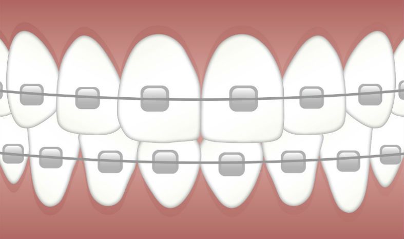 Best Electric Toothbrush for Braces 2019 dentistryblogger.com/best-electric-…