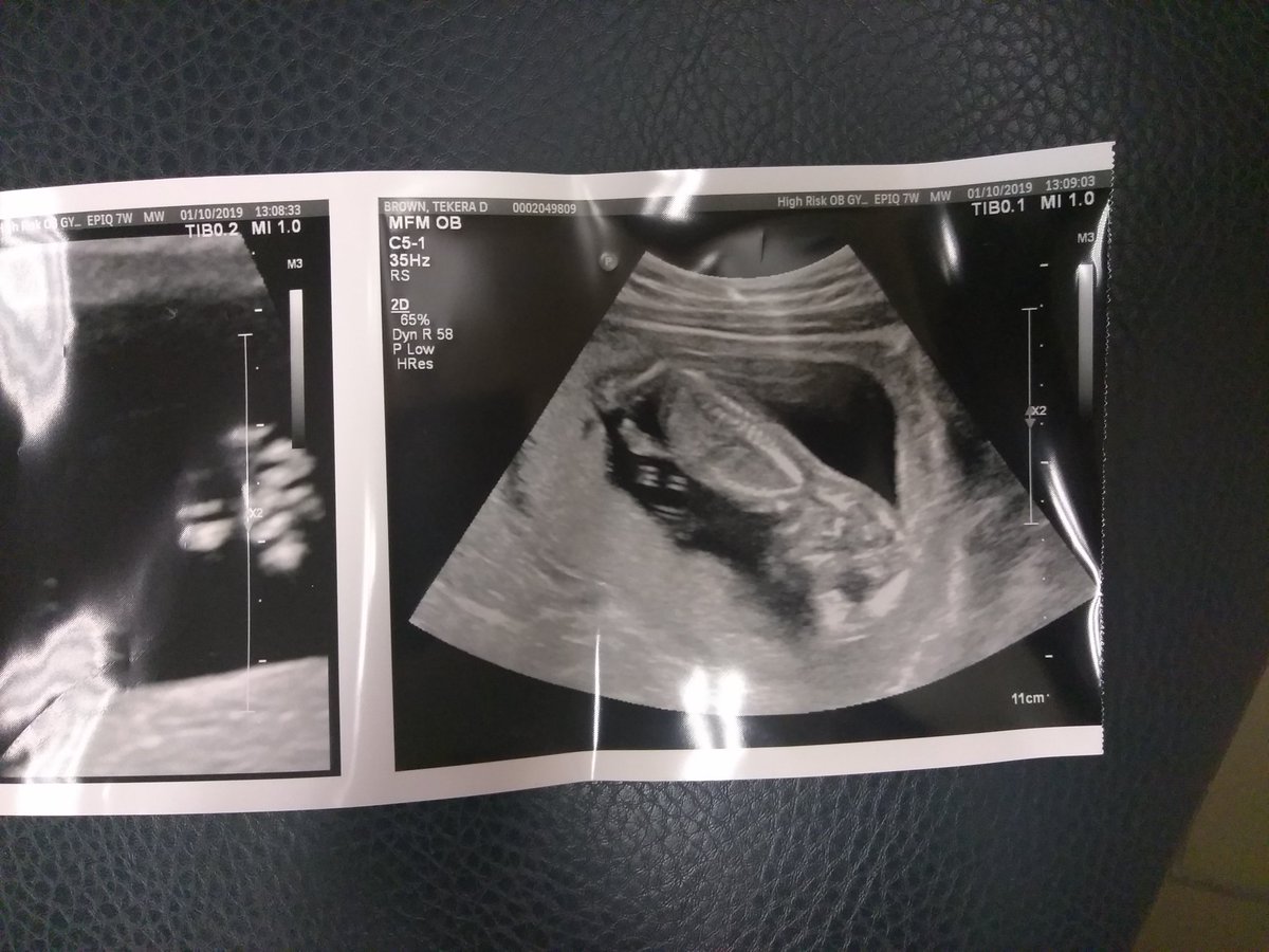 TekeraDestiny's tweet photo. My Son 😍💙👶 https://t.co/P7gjgFp2nM