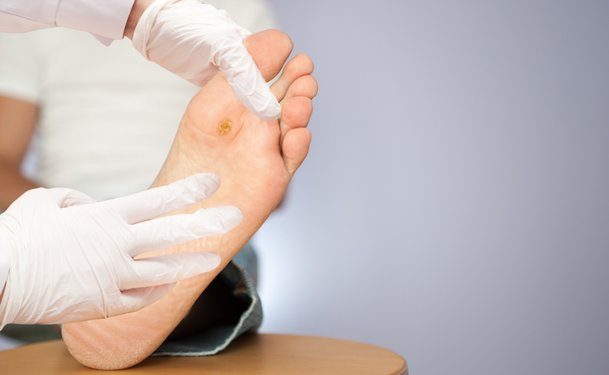 #Wounddressing market in US to attain $4.25 billion by 2024, rising aging population and cases of #diabetes and #obesity are the major driving factors. #woundinfections #diabeticfoot bit.ly/2D3TlQ4